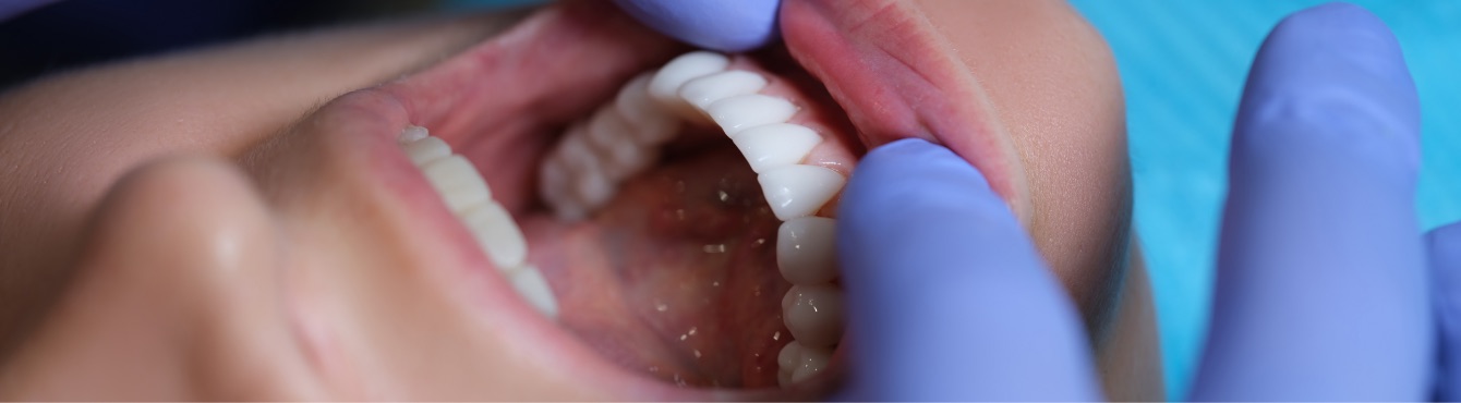 cobo-garrido-clinica-dental-madrid-periodoncia